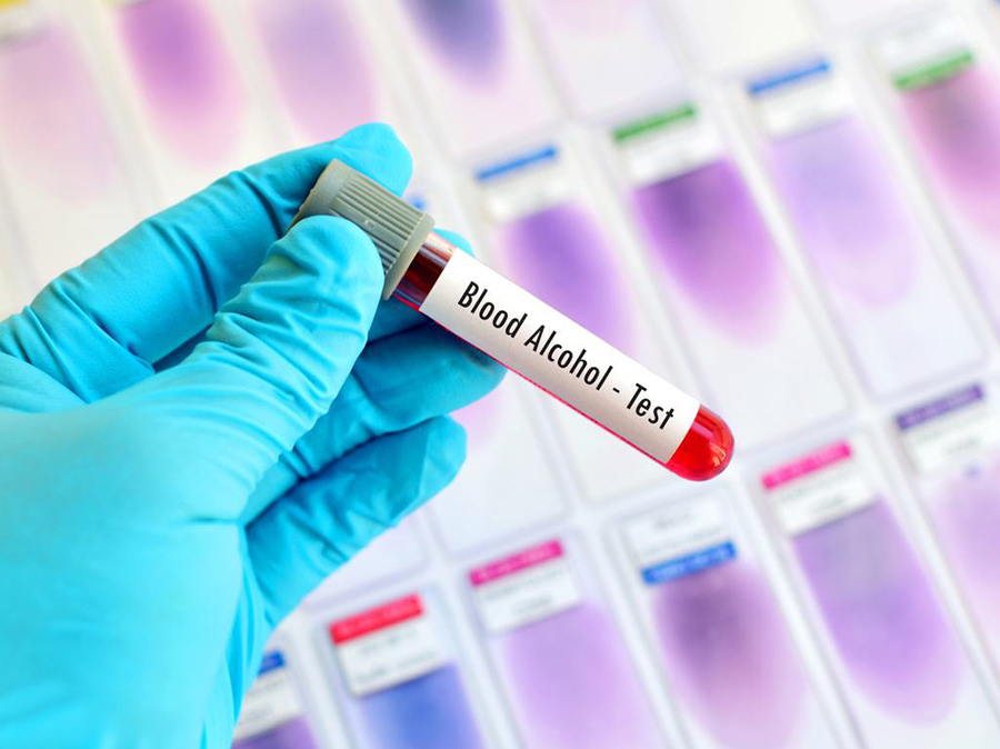 天门妇保院可以做DNA亲子鉴定吗,天门医院办理血缘检测详细流程及材料